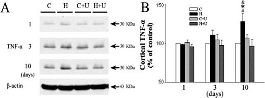 Fig. 4. Effects of DOR activation and inhibition on cortical TrkB at 24 hrs after MCAO. A, Representative Western blot images of TrkB expression in different groups. B, Quantitative analysis of 140 KDa full-length TrkB (n=4). S, Sham control. M, MCAO. *P< 0.05 vs. the sham control. #P< 0.05 vs. M + TAN67 (a DOR agonist). Note that MCAO significantly reduced the expression of 140 KDa TrkB in the cortex, while DOR activation with TAN67 largely reversed such ischemic reduction. Cited from Tian et al. [107].