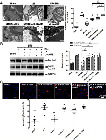 Fig. 8. Co-treatments with Akt and/or eNOS inhibitors attenuates the anti-autophagic effects of bilobalide. Electronic microscope images of autophagic vacuoles (A), immunoblotting of Beclin-1 and LC3-II/LC3-1 ratio (B) and immunostaining of LC3 foci (shown in red) (C) revealed that pharmacologic inhibition of Akt and/or eNOS signaling pathways partially ablates the anti-autophagic effects of bilobalide (10mg/kg) following I/R injury to the brain. Data are presented as mean±SD. n=12 rats per group at 24 hour time point; n=10 rats per group at 7 day time point. ** : p< 0.01; *, Δ or # : p< 0.05.