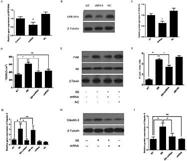 Fig. 6. Sodium butyrate promotes Claudin-3 expression and Akt phosphorylation, and increases colonic epithelium TEER via GPR109A. (A) The shRNA plas-mid reduced the expression of GPR109A mRNA in Caco-2 cells, but the NC plasmid failed to decrease the levels of GPR109A mRNA (n = 3, *P< 0.05, **P< 0.01). (B) Representative immunoblotting and (C) relative quantification analyses of GPR109A protein (n = 3, *P< 0.05, **P< 0.01). (D) TEER in Caco-2 cells transfected with 30 ng/µL shRNA plasmids (n = 3, *P< 0.05, **P< 0.01). (E) Representative immunoblotting and (F) relative quantification analyses of Akt in Caco-2 cells at 15 min after GPR109A-shRNA knockdown (n = 3, *P< 0.05, **P< 0.01). (G) Claudin-3 mRNA levels in Caco-2 cells transfected with 30 ng/µL NC and shRNA plasmids (n = 3, *P< 0.05, **P< 0.01). (H and I) Expression of Claudin-3 protein in Caco-2 cells transfected with 30 ng/µL shRNA plasmids (n = 3, *P< 0.05, **P< 0.01).