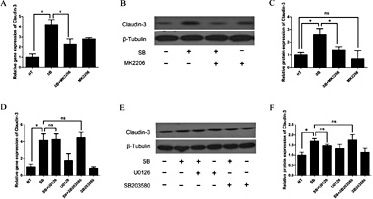 Fig. 7. Sodium butyrate up-regulates Claudin-3 expression via the Akt pathway. (A) Expression of Claudin-3 mRNA in Caco-2 cells pre-incubated with 10 µM MK2206 (an allosteric Akt inhibitor) for 2 h followed by incubation with sodium butyrate for 4 h (n = 3, *P< 0.05, **P< 0.01). (B and C) Representative immunoblots and quantification of relative Claudin-3 protein levels in Caco-2 cells treated with or without 10 µM MK2206 and sodium butyrate (n = 3, *P< 0.05, **P< 0.01). (D) Expression of Claudin-3 mRNA in Caco-2 cells pre-incubated with 10 µM U0126 (a highly selective inhibitor of ERK kinase) and 10 µM SB203580 (a specific inhibitor of P38) for 2 h followed by incubation with sodium butyrate for 4 h (n = 3, *P< 0.05, **P< 0.01). (E and F) Representative immunoblots and quantification of relative Claudin-3 protein levels in Caco-2 cells pre-incubated with 10 µM U0126 and 10 µM SB203580 for 2 h followed by incubation with sodium butyrate for 4 h (n = 3, *P< 0.05, **P< 0.01).