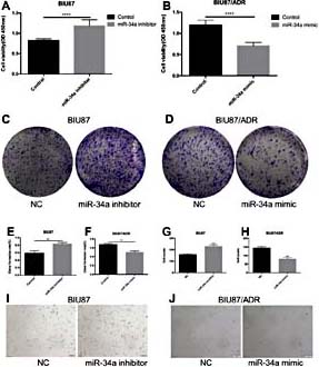 Fig. 2. miR-34a attenuates bladder cancer proliferation in vitro. (A) Inhibition of miR-34a reduced EPI-induced cell growth in BIU87cells. (B) Overexpression of miR-34a enhanced EPI-induced cell growth in BIU87/ADR cells. (C, E) Inhibition of miR-34a increased bladder cancer migration in BIU87 cells. (D, F) Overexpression of miR-34a decreased bladder cancer migration in BIU87/ADR cells. Morphological analysis of (G, I) BIU87 cells compared with BIU87 miR-34a inhibition and (H, J) BIU87/ADR cells compared with the BIU87/ADR miR-34a mimic. *p< 0.05; **p< 0.01; ***p< 0.001.