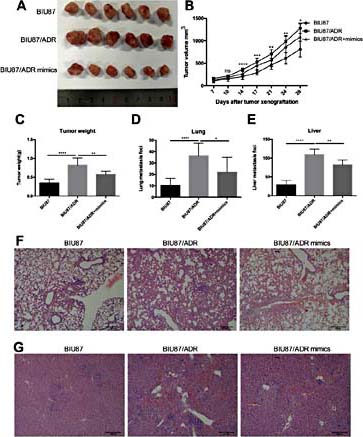 Fig. 6. miR-34a attenuates bladder cancer chemoresistance and metastasis in vivo. (A) Representative tumors show significantly larger xenografts with BIU87/ADR than in the miR-34a overexpression group and BIU87 group. (B) Increased tumor volumes over time in EPI-treated mice, especially for xenografted BIU87/ADR tumors. (C) Significantly greater tumor weight at the end of the treatment period (28 days after bladder cancer cell injection) in the BIU87/ADR group. Data are shown as means ± SD (n = 6, P < 0.05). (D, F) Overexpression of miR-34a reduced bladder cancer lung metastasis in vivo. The mice were sacrificed 28 days after cell injection, and lung surface nodules were counted under microscopy. (E, G) Overexpression of miR-34a reduced bladder cancer liver metastasis. The mice were sacrificed 28 days after cell injection, and liver surface nodules were counted. *p< 0.05; **p< 0.01; ***p< 0.001.