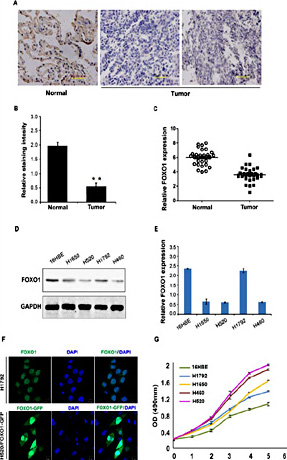 Fig. 1. FOXO1 expression in NSCLC tissues and cell lines. (A), (B) Immunohistochemical analysis showing FOXO1 levels in lung cancer tissues and adjacent lung tissues. Scale bar, 100 μm. (C) Real-time PCR analyses of FOXO1 were performed in 30 paired human tumor and normal tissues. (D, E) Western blotting and realtime PCR analysis showing FOXO1 level in various lung cancer cell lines. (F) Immunofluorescence staining to detect the localization of FOXO1. Scale bar, 10 μm. (G) The proliferation of H1792, H1659, H520, H460, and H16BE cells.