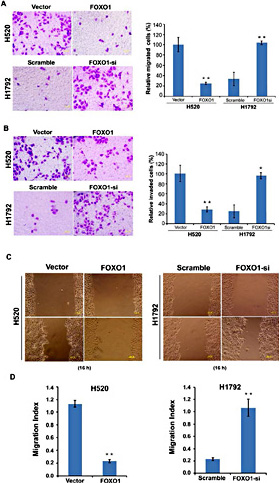 Fig. 3. FOXO1 inhibits the migration and invasion of NSCLC cells. (A) Cell migration and (B) cell invasion as determined by Transwell analysis in H520/FOXO1 and H1792/FOXO1si cells compared with control or scramble cells; *p< 0.05, ** p< 0.001. (C) Wound-healing assay to assess the effect of FOXO on cell mobility in H520/FOXO1 and H1792/FOXO1si cells. The cells were measured over 16 h by wound-healing assay. Statistical analysis showed the percentage of cell migration. (D) Statistical analysis showing the percentage of cell migration.