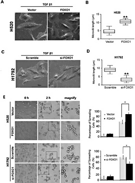 Fig. 5. FOXO1 alters cell surface ultrastructure. (A) Scanning election microscope images of H520/FOXO1 and H520/Vector cells with TGF-β1 treatment (10 ng/ml) for 48 h. (B) The box and whisker graph represent the length of the microvilli in H520/FOXO1 and H520/Vector cells, which were measured using the Line Tool of Image J software. (C) Scanning election microscope images of H1792/scramble and H1792/FOXO1si cells with TGF-β1 treatment (10 ng/ml) for 48 h. (D) The box and whisker graph represent the length of the microvilli in H1792/scramble and H1792/FOXO1si cells. (E) H520/FOXO1, H1792/siFOXO1 and control cells spread on the surface of 6-wells plate at the indicated time points: 0 and 2 h. Scale bar, 100 mm.