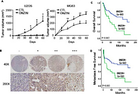 Fig. 8. ONZIN overexpression contributes to osteosarcoma progression in vivo. (A) Tumor growth curves from the xenograft experiments using ONZIN-overexpressing MG63 and U2OS cells. (B) Representative immunohistochemical staining for ONZIN in tissue microarray at magnifications of 40× and 200×. High ONZIN expression was associated with lower (C) overall survival and (D) metastasis-free survival. (-) and (+) indicate negative and positive staining.