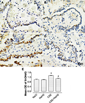 Fig. 1. NaHS alleviates CSE-induced DNA oxidative damage in placentas. (A-D) Representative images for 8-OHdG immunostaining of placentas in the NaCl, NaHS, CSE and CSE+NaHS groups, respectively. (E) Comparisons of optical density (OD) values of 8-OHdG in the NaCl, NaHS, CSE and CSE+NaHS groups. *P< 0.05 vs. NaCl group; #P< 0.05 vs. CSE group. n=6 per group.