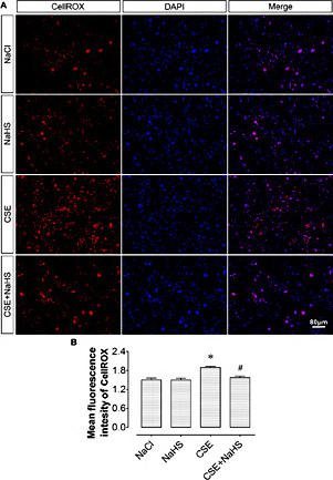 Fig. 3. NaHS inhibits ROS production induced by CSE in placentas. (A) Representative fluorescent images of placentas stained with CellROX in the NaCl, NaHS, CSE and CSE+NaHS groups, respectively. (B) Comparisons of the mean fluorescence intensity of CellROX in the NaCl, NaHS, CSE and CSE+NaHS groups. *P< 0.05 vs. NaCl group; #P< 0.05 vs. CSE group. n=6 per group.