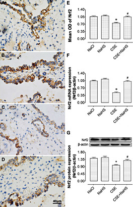 Fig. 5. NaHS augments Nrf2 expression suppressed by CSE in placentas. (A-D) Representative images for Nrf2 immunostaining in placentas of the NaCl, NaHS, CSE and CSE+NaHS groups, respectively. (E) Comparisons of optical density (OD) of Nrf2 in the NaCl, NaHS, CSE and CSE+NaHS groups. (F) Comparisons of the mRNA expression levels of Nrf2 in placentas from the NaCl, NaHS, CSE and CSE+NaHS groups. (G) Representative immunoblots (upper) and densitometric analysis (lower), respectively, of Nrf2 protein expressions in the NaCl, NaHS, CSE and CSE+NaHS groups. *P< 0.05 vs. NaCl group; #P< 0.05 vs. CSE group. n=6 per group.