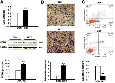 Fig. 3. Increased proliferation, migration and apoptotic resistance in MCT-PASMCs. (A) Proliferation of PASMCs was significantly potentiated in MCT-treated rats. PASMCs viability was assessed by MTS assay with OD 490 nm values (top, n = 5 each). Western blots showing PCNA and β-actin protein expression in CON and MCTPASMCs (middle). Increased PCNA protein expression in MCT-PASMCs normalized to β-actin protein (bottom, n = 3 each). (B) Migration to the bottom of the Transwell chambers in PASMCs of CON and MCT-treated rats. The number of migrated cells was normalized to CON-PASMCs. n = 5 each. (C) Apoptosis was depressed in MCT- PASMCs measured by flow cytometer. n = 4 each. Scale bars, 100μm. Data are presented as mean ± SEM. **P < 0.01 vs CON.