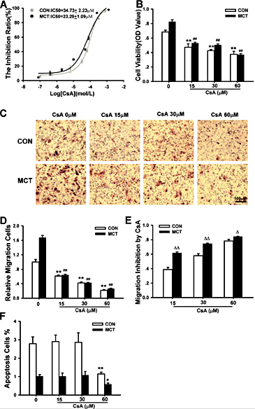 Fig. 5. CsA induced inhibition of proliferation and migration and apoptosis in PASMCs of CON and MCT-induced PAH rats. (A) Dosedependent effect of growth inhibition in PASMCs treated with CsA by MTS method in CON and MCT rats (n = 5 each). (B) Proliferation of PASMCs was attenuated with three doses (15, 30 and 60 µM) of CsA added to MCT-PASMCs (n = 4 each). (C) Representative migration images demonstrating suppression of migration with CsA treatment in CON and MCT-PASMCs. (D) Compared with CON or MCT group without CsA intervention, three dosage CsA-pretreated groups all showed inhibition of migration in PASMCs. The number of migrated cells was normalized to CON-PASMCs. n = 5 each. (E) The migration inhibition rate of MCT-PASMCs with CsA was higher than that of CON-PASMCs with CsA. n = 5 each. (F) Apoptosis of MCT-PASMCs was inhibited by 60µM CsA. Compared with CON or MCT group, 15 µM and 30 µM doses of CsA had no effect on the apoptosis in PASMCs, only high dose (60 µM) CsA could attenuate the apoptosis of PASMCs (n = 3-5). Scale bars, 100μm. Data are presented as mean ± SEM. **P < 0.01 vs CON without CsA treatment, # P < 0.05, ## P < 0.01 vs MCT-PASMCs rats without CsA treatment. Δ P < 0.05, ΔΔP < 0.01 vs CON with CsA treatment.