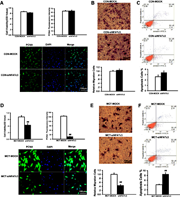 Fig. 8. Knockdown NFATc3 by siRNA attenuated proliferation, migration and apoptosis resistance of MCT-PASMCs. After transfection with NFATc3 siRNA, PASMCs were cultured for 24 hours. Knockdown NFATc3 had no effect on proliferation (A), migration (B) and apoptosis (C) of PASMCs in CON rats. The number of migrated cells was normalized to CONMOCK. Analysis of proliferation by MTS method ( n = 4 each) and PCNA immunofluorescence ( n = 23 each). n = 10 each for migration and n = 4 each for apoptosis. (D) Suppressed proliferation from PAH PASMCs treated with lipofectamine transfection reagent (MOCK) or siRNA targeted to NFATc3 (siNFATc3) by MTS method (top left, n = 5 each) and immunofluorescence analysis of PCNA expression (top right, n = 33 each). (E) Inhibited migration to the bottom of the Transwell chambers of PASMCs transfected with siNFATc3 in MCT-reduced PAH rats. The number of migrated cells was normalized to MCT-MOCK. n = 5 each. (F) Increased apoptosis rate in PASMCs transfected with siNFATc3 from MCT-reduced PAH rats. n = 4 each. Scale bars, 100μm. Data are presented as mean ± SEM. ##P < 0.01 vs MCT-MOCK.
