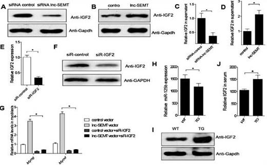 Fig. 8. lnc-SEMT regulates the expression of IGF2. (A) Western blot analysis of IGF2 protein abundances in sheep myoblasts transfected with control siRNA or lnc-SEMT siRNA. (B) Western blot analysis of IGF2 protein abundances in sheep myoblasts transfected with control vector or lnc-SEMT vector. (C) ELISA analysis of secreted IGF2 protein abundances in supernatant from sheep myoblasts transfected with control siRNA or lnc-SEMT siRNA. (D) ELISA analysis of secreted IGF2 protein levels in supernatant from sheep myoblasts transfected with control vector or lnc-SEMT vector. Mean values ± SEM, n=3, * P< 0.05.(E)Real-time PCR analysis of IGF2 expression levels in sheep myoblasts transfected with control siRNA or IGF2 siRNA.Mean values ± SEM, n=5, * P< 0.05. (F) Western blot analysis of IGF2 protein levels in sheep myoblasts transfected with control siRNA or IGF2 siRNA. (G)Real-time PCR analysis of expression of myogenic gene in sheep myoblasts transfected with control vector or lnc-SEMT vector or control vector with IGF2 siRNA or lnc-SEMT vector with IGF2 siRNA. (H) Real-time PCR analysis of miR-125b expression in longissimus dorsi musclefrom WT and TG sheep. Mean values ± SEM, n=5, * P< 0.05. (I) Western blot analysis of IGF2 protein abundances in longissimus dorsimuscle from WT and TG sheep. (J) ELISA analysis of IGF2 protein abundances in serum from WT and TG sheep. Mean values ± SEM, n=5, * P< 0.05.