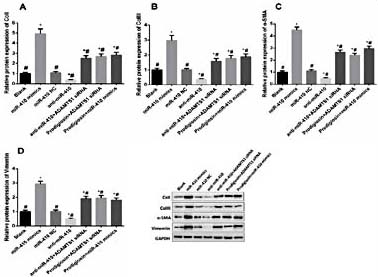 Fig. 9. Western blotonrelative Protein expression of Col I (A), Col III (B), α-SMA (C)and Vimentin (D) (* indicated P< 0.05 compared with Normal group, # indicated P< 0.05 compared with Model group).