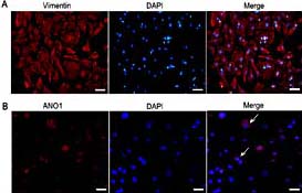 Fig. 1. Identification of the phenotype of rat cardiac fibroblasts (CFs) and the expression of ANO1. (A) vimentin immunostaining (red). Scale bar = 50 μm. (B) ANO1 immunostaining (red). ANO1 localized predominantly at the nuclear membrane and partially within intracellular compartments around nucleus in CF, especially at mitotic phase (indicated by white arrows). Scale bar = 25 μm.