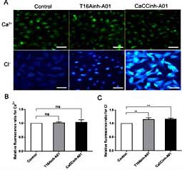 Fig. 2. The effects of T16Ainh-A01 and CaCCinh-A01 on intracellular Ca2+ and Cl– concentrations in primary CFs. (A) intracellular Ca2+ and Cl– were detected by Fluo 4-AM (upper) and MQAE probe staining (lower), respectively. (B-C) quantitative analysis of intracellular Ca2+ and Cl– density. Data are expressed as mean ± SEM; n=5; ns, no significant difference, **P< 0.01 represents statistical comparisons of inhibitors versus controls. Scale bar = 25 μm.