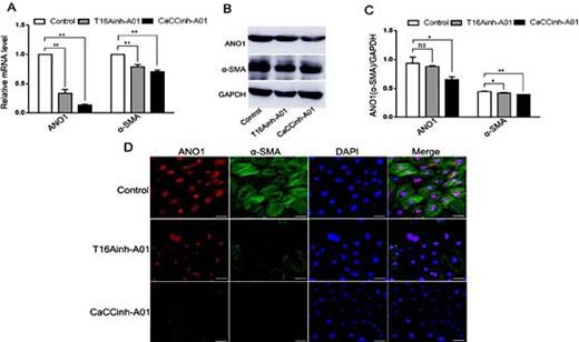 Fig. 3. The expression of ANO1 and α-SMA in rat CFs after treatment with T16Ainh-A01 and CaCCinh-A01 for 48 h. (A) qRT-PCR data show the mRNA expressions of ANO1 and α-SMA. (B-C) Western blot data show the protein expressions of ANO1 and α-SMA. (D) expression of ANO1 and α-SMA by immunoflurescence staining. ANO1 and α-SMA were red and green, respectively, and nuclei were identified by DAPI staining (blue). ns, no significant difference; *p< 0.05, vs. control; **p< 0.01, vs. control. Scale bar = 40 μm.