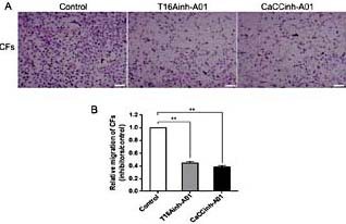 Fig. 6. The effects of T16Ainh-A01 and CaCCinh-A01 on cell migration of rat CFs. (A) representative staining images for transmigrated cells. The cells in T16Ainh-A01 and CaCCinh-A01 groups were treated with T16Ainh-A01 (10 μM) or CaCCinh-A01 (30 μM) for 24 h. (B) the calculated relative ratios of the transmigrated cells. Data are expressed as mean ± SEM, **p< 0.01, vs. control. Scale bar = 100 μm.