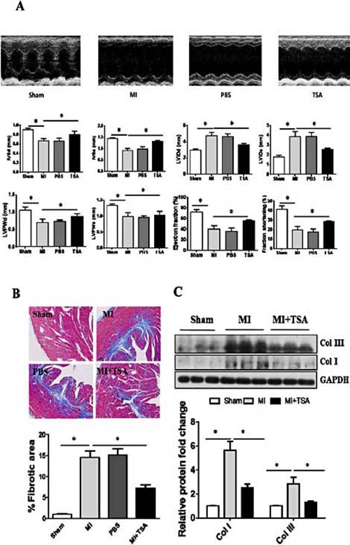 Fig. 1. Histone deacetylase inhibition by TSA augments restoration of ventricular function and prevents cardiac remodeling in mice with MI. A, Representative images (upper panel) and results (lower panel) of echocardiographic assessment of hearts subjected to left anterior descending coronary ligation (n=5). B, Representative and quantitative analysis of Masson trichrome staining of cardiac tissue obtained from the different groups. C, Immunoblot analysis of collagen I and III protein expression in myocardium from the different mouse groups. *P< 0.05 vs the indicated group. MI, myocardial infarction; PBS, phosphate-buffered saline; TSA, trichostatin A; IVSd, interventricular septum thickness at end-diastole; IVSs, interventricular septal thickness at end-systole; LVIDd, left ventricular internal diastolic diameter; LVIDs, left ventricular internal systolic diameter; LVPWd, left ventricular diastolic posterior wall thickness; LVPWs, left ventricular systolic posterior wall thickness; Col, collagen.