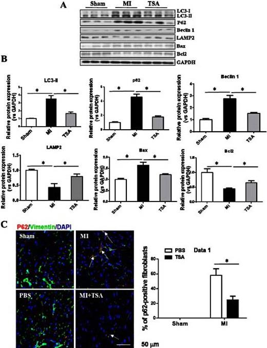 Fig. 2. TSA inhibits MI-induced impairment of autophagosome clearance in vivo. A, Immunoblots and (B) quantitative analysis of LC3, P62, beclin 1, LAMP2, Bcl2 and Bax protein expression in mice myocardium from the different groups (n=3). C, Representative immunofluorescence and quantitative analysis of P62 and the cardiac fibroblast marker vimentin (n=3). *P< 0.05 vs the indicated group. MI, myocardial infarction; TSA, trichostatin A.