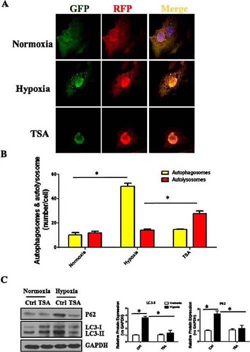 Fig. 4. TSA treatment restores hypoxia-induced impairment of autophagic flux in NRCFs. A, Representative immunofluorescence images demonstrating mCherry-GFP-LC3 localization in NRCFs cultured in a normoxic environment or after hypoxia with or without TSA; representative of 3 experiments. B, Quantitative analysis of autophagosomes (yellow bars) and autolysosomes (red bars) in NRCFs treated as in A (n=25–45 nuclei per group). C, Representative and quantitative analysis of immunoblots depicting LC3 processing and P62 abundance. *P< 0.05 vs the indicated group (n=3). NRCFs, neonatal rat cardiac fibroblasts; GFP, green fluorescent protein; RFP, red fluorescent protein; TSA, trichostatin A; Ctrl, control.