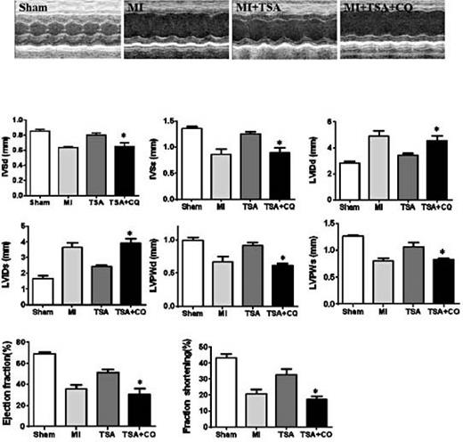 Fig. 6. CQ abolished TSA-improved cardiac functional recovery in MI hearts. Representative images (upper panel) and results (lower panel) of echocardiographic assessment of hearts subjected to left anterior descending coronary ligation. n=5, *P< 0.05 vs the indicated group. CQ, chloroquine; MI, myocardial infarction; PBS, phosphate-buffered saline; TSA, trichostatin A; IVSd, interventricular septum thickness at end-diastole; LVIDs, left ventricular internal systolic diameter.