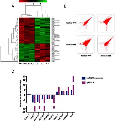 Fig. 1. Differential lncRNA expression between transparent and nuclear ARC lenses samples. (A) Heatmap was generated from the hierarchical cluster analysis to show differentially expressed lncRNAs between control and nuclear ARC lenses capsules. Red indicates down-regulation, and green indicates up-regulation. (B) Scatter plot was used to compare lncRNA expression differences between control and nuclear ARC lenses capsules. (C) Nine of 10 lncRNAs were verified by qRT-PCRs to be differentially expressed between nuclear ARC and transparent lens. Log2Ratio change of lncRNA sequencing and fold change of qRT-PCRs were presented.
