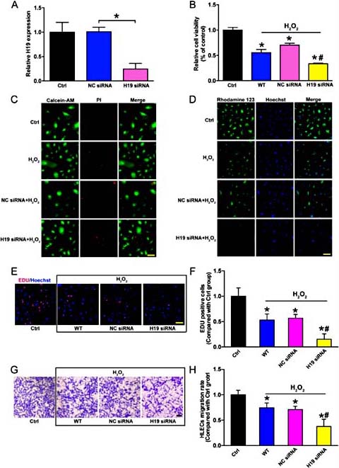 Fig. 3. Effects of H19 knockdown on HLEC function. (A-H) Primary cultured HLECs were transfected with H19 siRNA, scrambled siRNA (NC) or left untreated. (A) qRT-PCRs were conducted to detected H19 expression levels. *P< 0.05. (B-H) After transfection, HLECs were exposed with or without H2O2 (50μM) for an additional 48 h. (B) Cell viability was detected using the MTT method. *P< 0.05. (C) Apoptotic cells were analysed using PI and Calcein-AM double staining; Green: live cells, Red: dead or dying cell; Scale bar: 50 μm. (D) Mitochondrial membrane potentials were detected using Rhodamine 123 and Hochest 33342 double staining; Scale bar: 20 μm. (E and F) HLEC proliferation was detected using EdU assay and observed using a fluorescence microscope; Scale bar: 20μm. (G and F) HLEC migration was analysed using transwell assay, Scale bar: 50μm. “*” indicates significant difference compared with the control group; “#” indicates significant difference compared with H2O2 treatment group, P< 0.05.