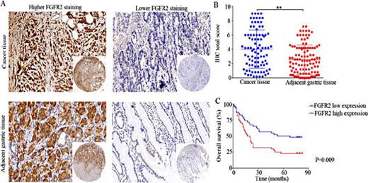 Fig. 1. Expression of FGFR2 in paired gastric cancer (GC) tumor and adjacent tissue samples, and survival analysis of GC patients. (A) Representative micrographs showing higher FGFR2 staining and lower FGFR2 staining in GC tissues and adjacent tissues (magnification, ×200). (B) Quantification of FGFR2 expression in GC tissues compared with adjacent tissues. (C) Kaplan-Meier survival curves of GC patients with FGFR2 high expression and FGFR2 low expression. Data are presented as mean ± SEM (**P< 0.01).