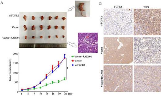 Fig. 5. RAD001 inhibits tumor growth and elevates TSP4 expression in xenograft model. Mice were randomly divided into three groups (SGC7901 cells with FGFR2-knockdown group, vector group, and vector + RAD001group). RAD001 was administered by oral gavage (2 mg/kg/day). (A) Tumor tissues at the end of treatment and tumor volumes over 21 days. (B) Representative IHC staining of FGFR2 and TSP4 from tumor samples in each group (magnification, ×200). Data are presented as mean ± SEM (**P< 0.01).