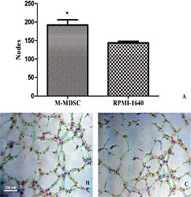 Fig. 1. M-MDSCs promote HUVEC tube formation in vitro. (a) Number of nodes on the tubes stimulated with the culture supernatant of M-MDSCs from E. granulosus-infected mice and RPMI-1640. (b) HUVEC tube formation stimulated with the culture supernatant of M-MDSCs from E. granulosus-infected mice. (c) HUVEC tube formation stimulated with RPMI-1640. *P< 0.05 versus Control.