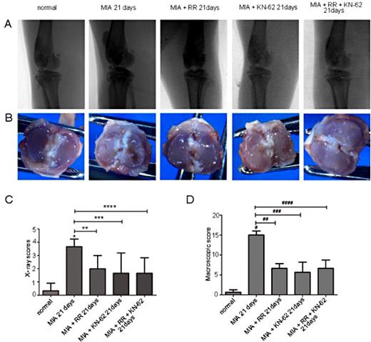 Fig. 2. Macroscopic and radiographic analyses and effects of ruthenium red or KN62 treatment can delay OA progression in the MIA-induced rat OA model. (A) Macroscopic photographs of tibial plateaus of the rat knee joints (B) X-ray photographs of the total knee joints (C) Radiographic scores measuring joint destruction (D) Macroscopic scores measuring joint destruction. Data are presented as mean ± SEM (n = 3). *P< 0.05 vs. control; **P< 0.05, ***P< 0.05, ****P< 0.05 vs. 6 μM MIA without therapy treatment. #P< 0.05vs. control; ##P< 0.05, ###P< 0.05, ####P< 0.05 vs. 6 μM MIA without therapy treatment. MIA, monosodium iodoacetate; RR, ruthenium red; KN-62, (1-[N,O-bis-(5-isoquinolinesulfonyl)-N-methyl-L-tyrosyl]-4-phenylpiperazine.