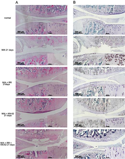 Fig. 3. Evaluation of the protective effect of the TRPV5 inhibitor (ruthenium red) and CAMKⅡ phosphorylation inhibitor (KN-62) by histological analysis and expression of p-CAMKⅡ correlated positively with the progression of osteoarthritis in an MIA-induced rat OA model. (A) Photomicrographs showing representative hematoxylin and eosin (H&E) staining of rat knee joints. (B) Photomicrographs showing representative immunohistochemical analyses of p-CAMKII expression of the articular chondrocyte in each group. Brown staining indicates specific p-CAMKII protein, and blue staining indicates the nucleus. The distribution of brown staining is positively correlated with p-CAMKII protein expression. (×40 and ×400 [inset] magnification for 2A, B and C). TRPV5, transient receptor potential channel vanilloid 5; MIA, monosodium iodoacetate; RR, ruthenium red; KN-62, 1-[N,O-bis-(5-isoquinolinesulfonyl)-N-methyl-L-tyrosyl]-4-phenylpiperazine; p-CAMKⅡ,Ca2+/Calmodulin-Dependent Kinase II phosphorylation.