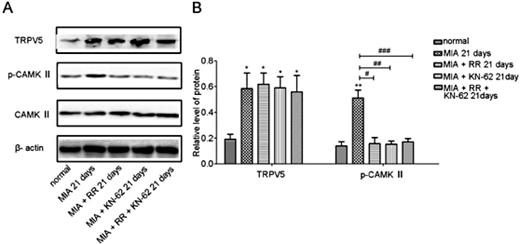 Fig. 4. TRPV5 and p-CAMKII protein expression in the articular cartilage of different group (A) TRPV5, p-CAMKⅡI protein expression from different stimulated groups at each time point as detected by Western blotting. (B) A bar graph showing the level of TRPV5, p-CAMKⅡ proteins in various groups. *P< 0.05 vs. untreated control, **P< 0.05, #P< 0.05, ##P< 0.05, ###P< 0.05, #P< 0.05, ##P< 0.05, ###P< 0.05 vs. MIA 21 day. Each column represents the mean ± SEM (n = 3). MIA, monosodium iodoacetate; RR, ruthenium red; KN-62, (1-[N,O-bis-(5-isoquinolinesulfonyl)-N-methyl-L-tyrosyl]-4-phenylpiperazine; p-CAMKⅡ,Ca2+/ Calmodulin-Dependent Kinase II phosphorylation.