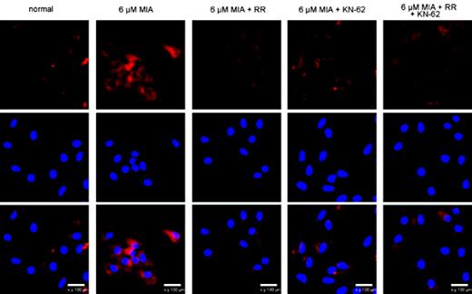 Fig. 6. P-CAMKII expression in different chondrocyte treatment groups. Expression of (A) p-CAMKII (red) was determined by immunofluorescence staining and blue staining indicates the nucleus (original magnification ×200). MIA, monosodium iodoacetate; RR, ruthenium red; KN-62, (1-[N,O-bis-(5-isoquinolinesulfonyl)-N-methyl-L-tyrosyl]-4-phenylpiperazine; p-CAMK, Ca2+/Calmodulin-Dependent Kinase II phosphorylation.