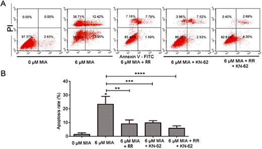 Fig. 7. Each group chondrocyte apoptosis detected by flow cytometry with Annexin V-FITC/PI staining of chondrocytes (A) Each group apoptotic chondrocytess distribution in flow cytometry machine. (B) Bar graph showing the apoptosis rate of each group. *P< 0.05 difference vs. untreated group (control); #P< 0.05; **P< 0.05, ***P< 0.05, ****P< 0.05 difference vs. 6 μM MIA without therapy treatment. Each column represents mean ± SEM (n = 3). MIA, monosodium iodoacetate; RR, ruthenium red; KN-62, (1-[N,O-bis-(5-isoquinolinesulfonyl)-N-methyl-L-tyrosyl]-4-phenylpiperazine.