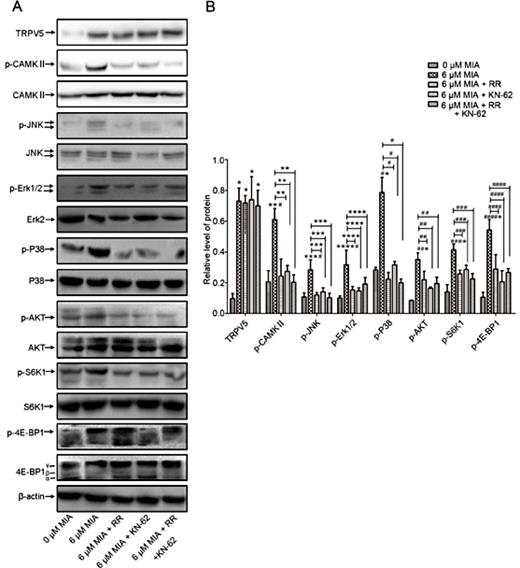 Fig. 8. Ca2+ mediated through TRPV5 elicited CaMKII phosphorylation activation leading to chondrocyte apoptosis by activating the MAPK and Akt/mTOR pathways (A) TRPV5, p-CAMKII, p-JNK, p-Erk, p-38, p-Akt, p-S6k1, p-4E-BP1 protein expression from groups were detected by western blotting. (B) A bar graph showing relative levels of TRPV5, p-CAMKⅡ, p-JNK, p-Erk, p-38, p-Akt, p-S6k1, p-4E-BP1 proteins. *P< 0.05; **P< 0.05; **#P< 0.05; ***#P< 0.05; ****#P < 0.05; #*P< 0.05; ##*P< 0.05; ###*P< 0.05 ####*P< 0.05 vs. untreated control. **P< 0.05; ***P< 0.05; ****P< 0.05; #P < 0.05; ##P< 0.05; ###P< 0.05; ####P< 0.05 vs. 6 μM MIA without therapy treatment. MIA, monosodium iodoacetate; RR, ruthenium red; KN-62, 1-[N,O-bis-(5-isoquinolinesulfonyl)-N-methyl-L-tyrosyl]-4-phenylpiperazine; TRPV5, transient receptor potential channel vanilloid 5; p-CAMKII, Ca2+/calmodulin-dependent kinase II phosphorylation; MAPK, mitogen-activated protein kinase; p-JNK, c-Jun N-terminal kinase phosphorylation; p-Erk, extracellular signal-regulated protein kinase phosphorylation; p-Akt, protein kinase B phosphorylation; 4E-BP1, 4E-binding protein; p-S6k1, S6 kinase 1 phosphorylation.