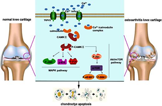 Fig. 9. Diagram of the signaling cascade The up-regulated TRPV5 could be an initiating factor that activate CaMKII phosphorylation via the mediation of Ca2+ influx. Activated p- CaMKII play a critical role in contributing to chondeocyte apoptosis via MAPK and Akt/mTOR pathways. MIA, monosodium iodoacetate; RR, ruthenium red; KN-62, 1-[N,O-bis-(5-isoquinolinesulfonyl)-N-methyl-L-tyrosyl]-4-phenylpiperazine; TRPV5, transient receptor potential channel vanilloid 5; p-CAMKII, Ca2+/calmodulin-dependent kinase II phosphorylation; MAPK, mitogen-activated protein kinase; p-JNK, c-Jun N-terminal kinase phosphorylation; p-Erk, extracellular signal-regulated protein kinase phosphorylation; p-Akt, protein kinase B phosphorylation; mTOR, mammalian target of rapamycin; 4E-BP1, 4E-binding protein; p-S6k1, S6 kinase 1 phosphorylation.