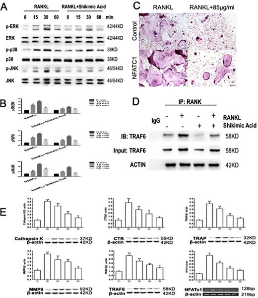 Fig. 5. Shikimic acid suppresses the MAPK pathway in osteoclastogenesis and markers of osteoclastogenesisrelated gene expression. (A) Western blot of phosphorylation of ERK, P38, and JNK, which were associated with the MAPK signaling pathway. (B) Quantification of phosphorylation of ERK, p38, and JNK. (C) TRAP staining of RAW264.7 cells with or without overexpression of NFATc. (D) Co-IP of interaction between TRAF6 and RANK. (E) NFATc1, Cathepsin K, CTR, TRAF6, MMP-9, and TRAP levels were assessed in five different groups: 1 RAW264.7 cells; 2 RAW264.7 cells incubated with M-CSF and RANKL; 3 RAW264.7 cells incubated with M-CSF, RANKL, and 21.25 μg/mL shikimic acid; 4 RAW264.7 cells incubated with M-CSF, RANKL, and 42.5 μg/mL shikimic acid; and 5 RAW264.7 cells incubated with M-CSF, RANKL, and 85 μg/mL shikimic acid. *P< 0.05, **P< 0.01, ***P< 0.001.