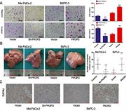  PIK3R3 enhanced the migration and invasion of PC cells. (A) PIK3R3 knockdown and overexpression respectively inhibited and promoted the migration and invasion of PC cells in vitro. (B) The effects of PIK3R3 on PC cell migration and invasion was investigated in vivo. (C) The expression of PIK3R3 in PC cell xenografts was detected by IHC. ** P&lt; 0.01. and *** P&lt; 0.001.