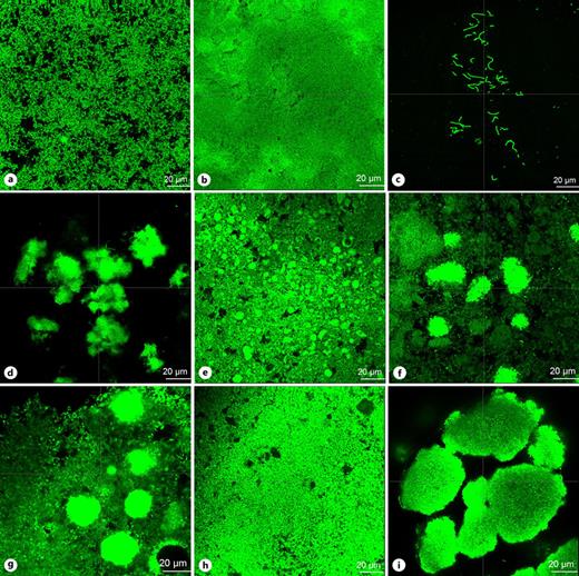 Representative confocal laser scanning microscope images of biofilm formed in different milk formulas. a Cow milk-based formula. b Partially hydrolyzed formula; pHF. c Extensively hydrolyzed formula; eHF. d Amino acid-based formula; AAF. e Soy-based formula. f Cow milk-based formula with 10% sucrose. g Cow milk-based formula with 18% sucrose. h Soy-based formula with 11% sucrose. i BHI broth with 10% sucrose (control).