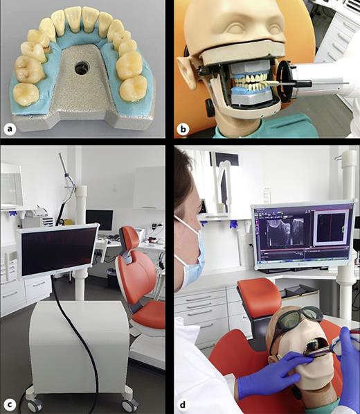 Sampling settings with the patient simulator. Extracted human premolars and molars in the tooth holder plate (a), bitewing taking (b), and intraoral OCT probe in the clinical setting (c) and use on the patient simulator (d).