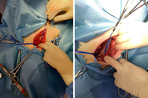 Surgical insertion of the double-lumen catheter at the jugular site of the animals.