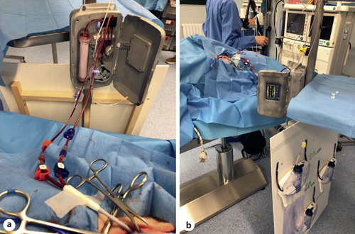 Setting of clinical operations. The anesthetized animal is supine while undergoing extracorporeal UF. The extracorporeal circuit is visible with the device placed vertically at the bedside. The ultrafiltrate collecting bags are placed at different height from the level of the filter and this allows for fine regulation of the UF rate.