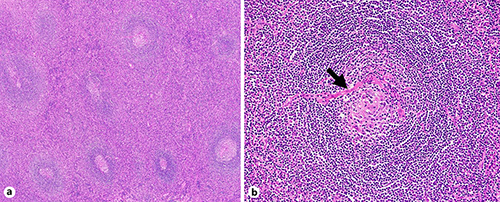 Fig. 4. Hematoxylin and eosin staining.