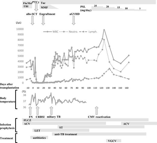 Clinical course after transplantation. Changes in the number of peripheral white blood cells (WBC), neutrophils, and lymphocytes, as well as changes in body temperature during hospitalization, are shown. Flu, fludarabine; Mel, melphalan; Tac, tacrolimus; MMF, mycophenolate mofetil; PSL, prednisolone; aGVHD, acute graft-versus-host disease; FN, febrile neutropenia; CRBSI, catheter-related bloodstream infection; TB, tuberculosis; CMV, cytomegalovirus; FLCZ, fluconazole; ACV, acyclovir; ST, sulfamethoxazole and trimethoprim; LET letermovir, VGCV, valganciclovir.