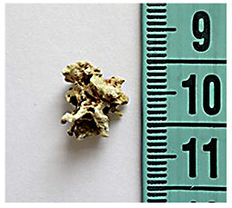 Fig. 2. Calcified material (15 mm) observed in the necrotic flow.