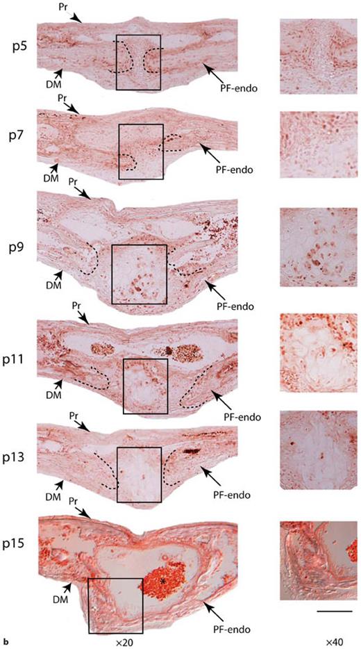Fig. 2. E-cadherin expression in posterior frontal suture during the first month of life. a Quantitative real-time PCR for E-cadherin on PF suture reveals up-regulation of E-cadherin gene starting at day p9 with maximal expression at days p13–p15, a period coinciding with active bone deposition in the PF suture and suture closure. Quantified mRNA values were normalized by the amounts of Gapdh mRNA, and results are given as fold induction. The results are presented as the mean ± SD of 3 independent experiments from 3 independent litters. * p < 0.05. b Immunohistochemistry analysis of E-cadherin protein performed using a specific E-cadherin antibody, shows at day p5 absence of positive cells in the suture mesenchyme PF suture (boxed area), while positive cells are detected in the surrounding osteogenic fronts. At day p7, a faint E-cadherin staining of few cells is observed, E-cadherin staining is also detected in pericranium and dura mater cells. Starting from day p9, more E-cadherin positive cells are detected in differentiating mesenchyme of the endocranial layer of PF suture. At day p15 an intense E-cadherin staining is observed in the bony bridge of closed endocranial layer of PF suture (boxed area). Boxed areas corresponding to the suture mesenchyme undergoing to endochondral ossification are magnified in panels on the right column. Dashed lines mark the osteogenic front of approaching bone plates Note, immunostaining is also observed in the area of suture populated by red blood cells, vessels and lymphocytes (asterisk). Pr = Pericranium; DM = dura mater; PF- endo = PF endocranial suture. Scale bar: 200 µm (at ×20) and 50 µm (at ×40).c Quantitative real-time PCR for E-cadherin performed on SAG suture and its comparison with expression profile observed in PF suture. Expression of E-cadherin gene in SAG suture remains steady during the first month of life. The results are presented as the mean ± SD of 3 independent experiments from 3 independent litters.