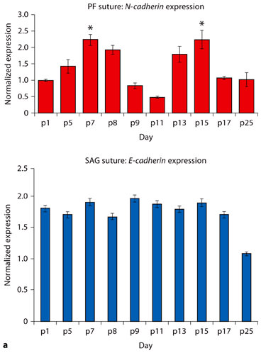 Fig. 3. aN-cadherin expression in the posterior frontal suture during the first month of life. Top panel: Quantitative real-time PCR for N-cadherin on PF suture reveals a biphasic expression profile of N-cadherin gene. N-cadherin is first up-regulated on p7, a period coinciding with a cellular condensation in the endocranial plate of the PF suture. A second phase of N-cadherin gene up-regulation is observed on p13–p15, a period marked by osteogenesis and closure of PF suture. Bottom panel: Quantitative real-time PCR for E-cadherin on SAG suture shows that the expression is steady overtime. Quantified mRNA values were normalized by the amounts of Gapdh mRNA, and results are given as fold induction. The results are presented as the mean ± SD of 3 independent experiments from 3 independent litters. * p < 0.05. b Immunolocalization of N-cadherin protein on PF suture using a specific anti-N-cadherin antibody mirrors the biphasic gene expression profile and localizes N-cadherin protein in the suture mesenchyme of the endocranial layer of PF suture during cellular precondensation at day p5 and p7. By day p9 only a few condroblasts present in the differentiating suture mesenchyme stain positively. At day p11 none of the cells present in the suture stain positive. In contrast, by day p13 a strong N-cadherin staining is observed in the endocranial layer of PF suture. Day p15, which marks the closure of PF suture, is also characterized by strong N-cadherin staining in the area of endochondral ossification (boxed area). Pericranium, osteoblasts and dura mater, also stain positively for N-cadherin. Boxed areas are magnified in panels on the right column. Pr = pericranium; DM = dura mater; PF-endo = PF endocranial suture. Scale bar: 200 µm (at ×20), 50 µm (at ×40).