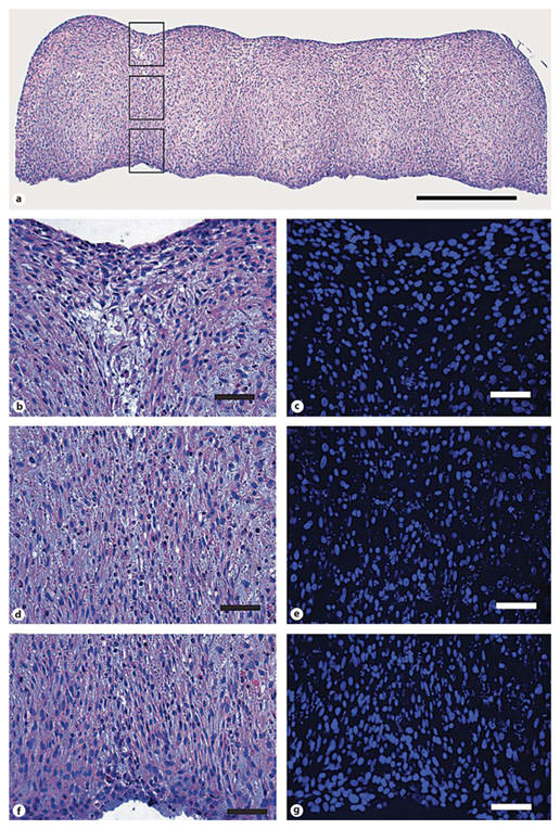 Fig. 8. Tissue tube morphology. Representative photomicrographs of tissue tubes cultured for a total of 14 days (7 days as rings, 7 days on silicone mandrels). The tube appears completely fused, although ring margins are visible by H and E staining (a; scale bar = 0.5 mm). Higher magnification views of the junction between the first two rings are highlighted in three parts corresponding to the boxes in a; the outer junction (b, c), the middle junction (d, e), and the inner junction closest to the silicone tube (f, g) stained with H and E (b, d, f) and Hoechst nuclear dye (c, e, g). Scale bars = 50 µm (b–g).